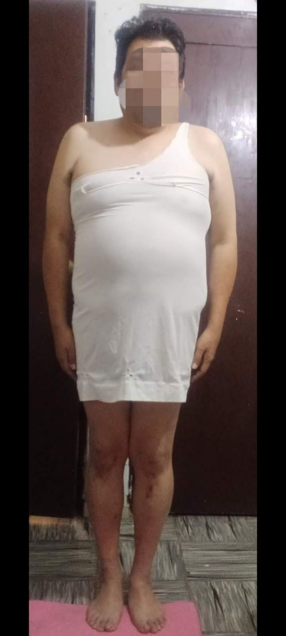 With short dress