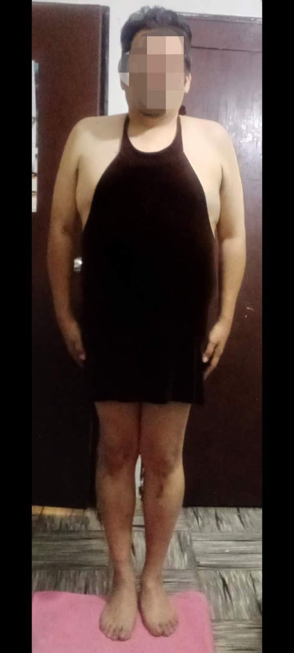 With short dress