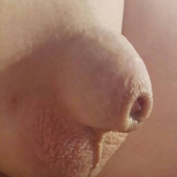 small penis on an adult baby